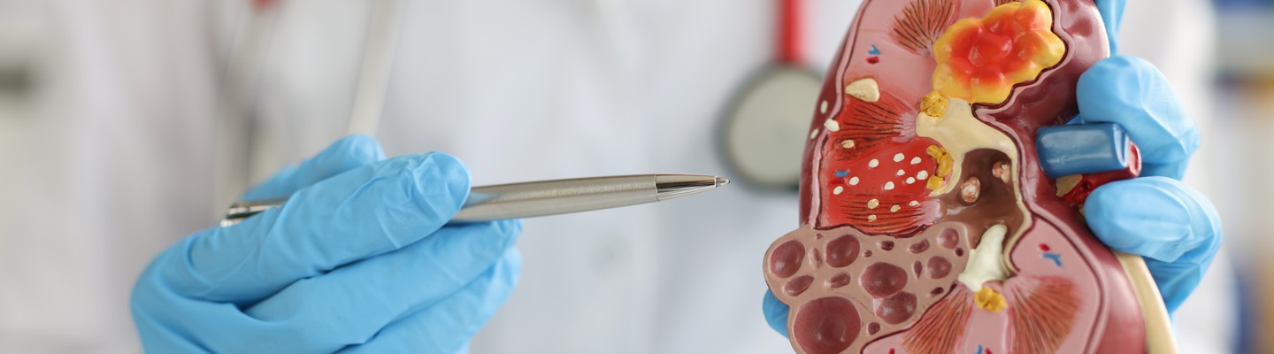 Nefrología en IntegraMédica