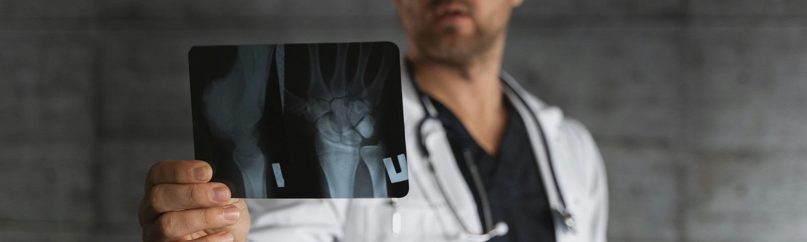 Dolor de manos: enfermedades que podrían estar detrás