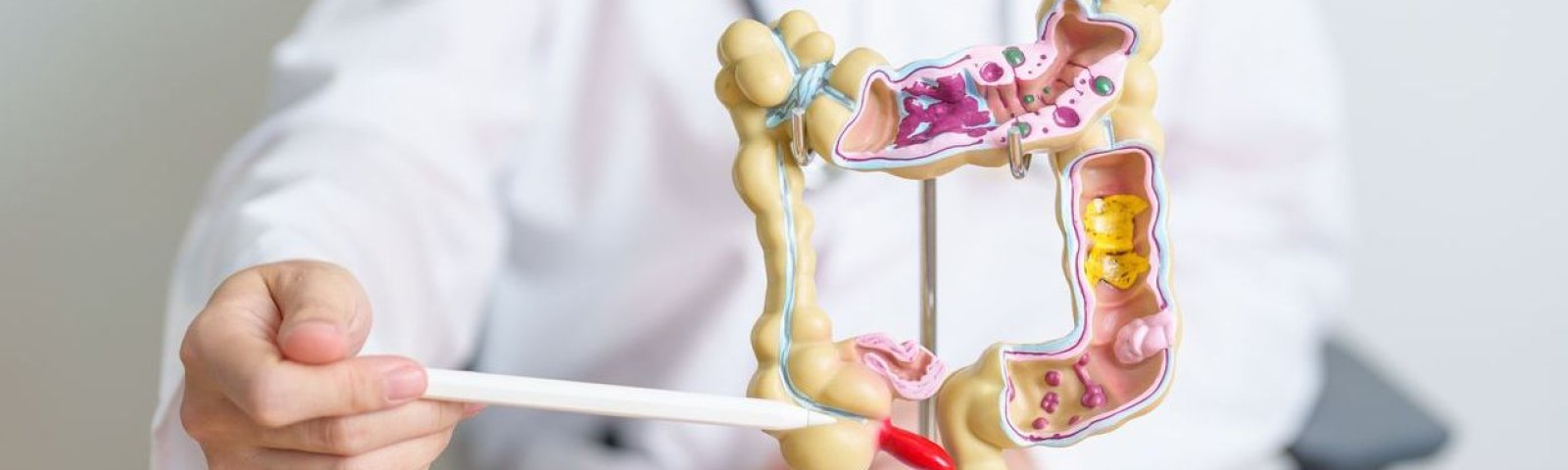 Colon irritable: cómo reconocerlo y qué hacer si lo padeces