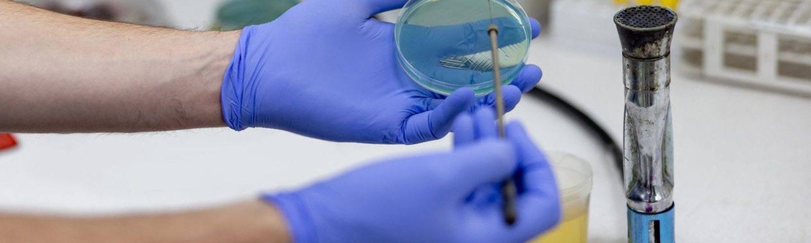 Urocultivo: ¿Qué es y cómo se realiza?