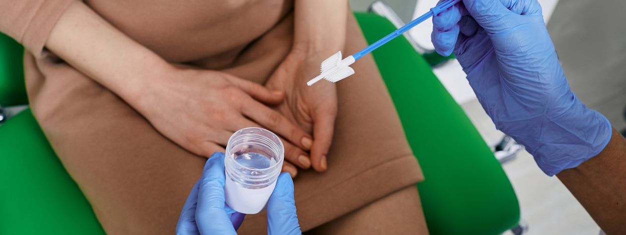 Detección del Virus Papiloma Humano en muestra de orina: todo lo que debes saber sobre este examen