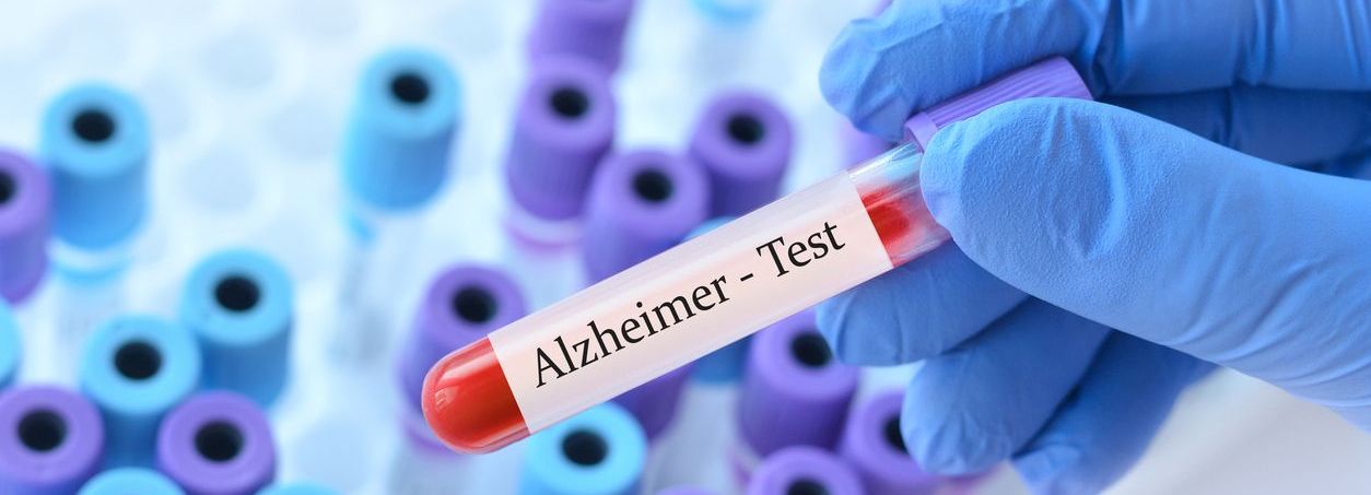 Evalúa tu salud cognitiva con el nuevo examen para detectar Alzheimer de forma temprana