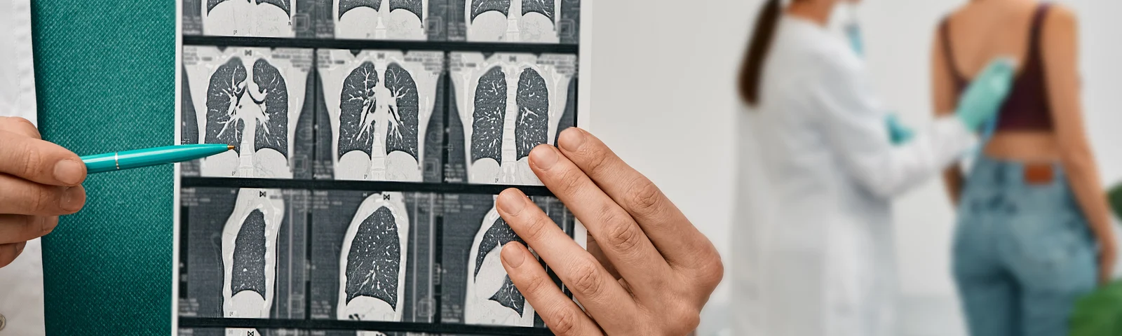 ¿Qué es la fibrosis pulmonar y cómo se trata?