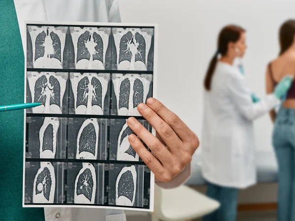 imagen del artículo