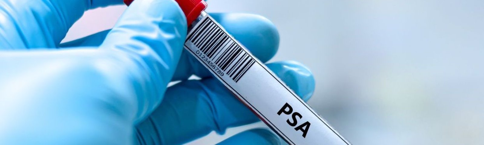 Examen de próstata: cuándo hacerlo, cómo se realiza y por qué es clave para tu salud