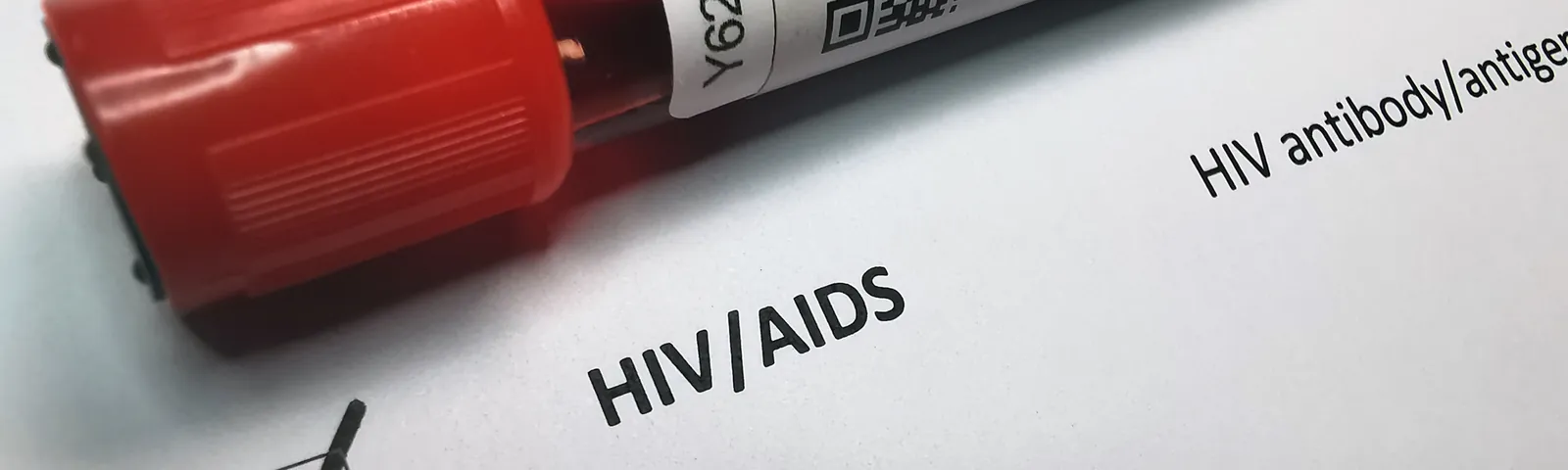 Examen VIH: cuándo hacerlo y cómo se realiza