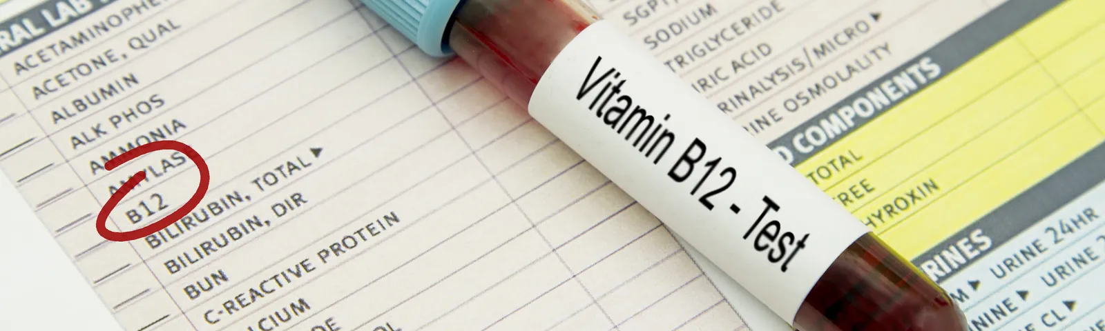 Vitamina B12: para qué sirve