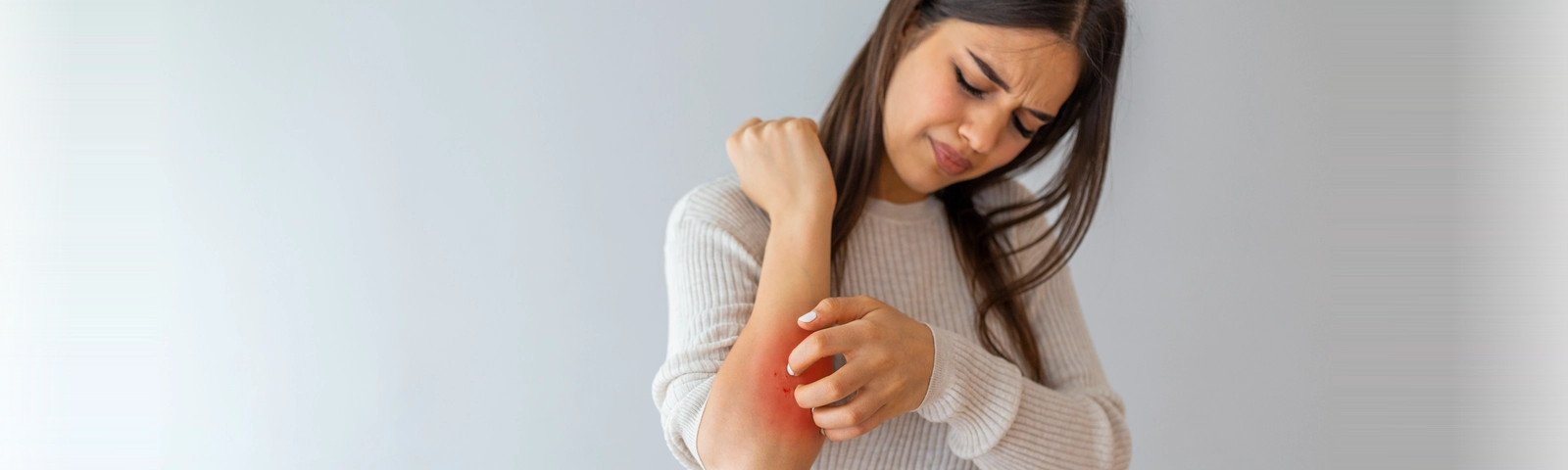 ¿Qué es la dermatitis atópica? Síntomas, causas y tratamientos